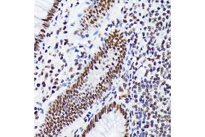 Immunohistochemistry of paraffin-embedded human appendix using EWSR1 Rabbit mAb (ABIN7267053) at dilution of 1:100 (40x lens). (EWSR1 antibody)
