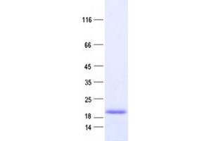 Western Blotting (WB) image for Cardiac Troponin C (TNNC1) protein (DYKDDDDK Tag) (ABIN2713171)
