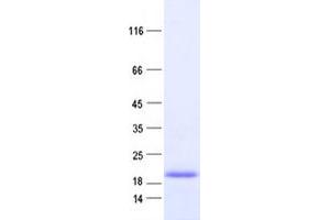 Validation with Western Blot (TNNC1 Protein (DYKDDDDK Tag))