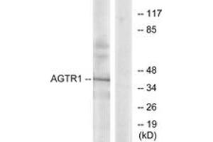 Western blot analysis of extracts from K562 cells, using AGTR1 Antibody. (Angiotensin II Type-1 Receptor antibody  (AA 101-150))