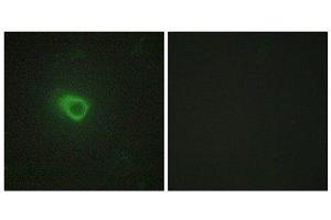 Immunofluorescence (IF) image for anti-Janus Kinase 1 (JAK1) (N-Term) antibody (ABIN1849257)