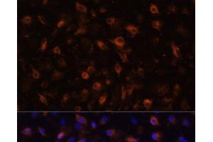 Immunofluorescence analysis of RAW264. (TLR4 antibody)