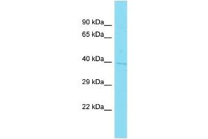 Host: Rabbit Target Name: C1orf198 Sample Type: NCI-H226 Whole Cell lysates Antibody Dilution: 1. (C1ORF198 antibody  (C-Term))