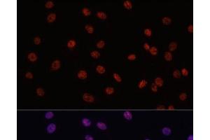Immunofluorescence analysis of C6 cells using MYCT1 Polyclonal Antibody at dilution of 1:100. (Myc Target 1 antibody)