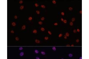 Immunofluorescence analysis of C6 cells using MYCT1 Polyclonal Antibody at dilution of 1:100.
