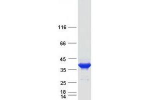 Validation with Western Blot