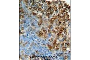 Immunohistochemistry (Paraffin-embedded Sections) (IHC (p)) image for anti-Inosine Triphosphatase (ITPA) (AA 24-51), (N-Term) antibody (ABIN651135)