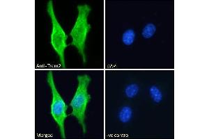ABIN570923 Immunofluorescence analysis of paraformaldehyde fixed 3T3-L1 cells, permeabilized with 0. (TREM2 antibody  (Internal Region))