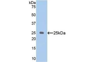 Detection of Recombinant PSA, Human using Polyclonal Antibody to Puromycin Sensitive Aminopeptidase (PSA) (NPEPPS antibody  (AA 584-793))