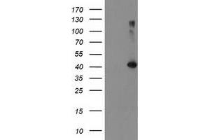 HEK293T cells were transfected with the pCMV6-ENTRY control (Left lane) or pCMV6-ENTRY TBC1D21 (Right lane) cDNA for 48 hrs and lysed. (TBC1D21 antibody)