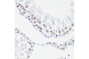 Immunohistochemistry of paraffin-embedded rat testis using MonoMethyl-Histone H4-R3 antibody (ABIN1680263, ABIN1680264, ABIN6220110 and ABIN6220114) at dilution of 1:100 (40x lens).