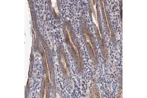 Immunohistochemical staining (Formalin-fixed paraffin-embedded sections) of human stomach with YARS2 polyclonal antibody  shows cytoplasmic positivity in glandular cells.