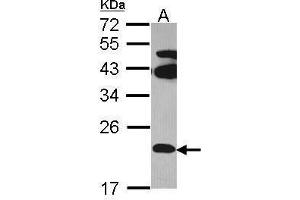WB Image Sample (30 ug of whole cell lysate) A: Hela 12% SDS PAGE FAM18B antibody antibody diluted at 1:1000 (TVP23C/FAM18B2 antibody  (Internal Region))