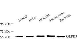 Western blot analysis of GLPK3 (ABIN7074046) at dilution of 1: 1000 (GLPK3 antibody)