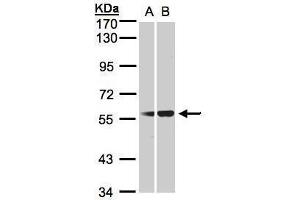 WB Image Sample(30 ug whole cell lysate) A:293T B:HeLa S3, 7. (SERPING1 antibody  (Center))