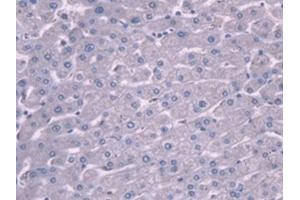 #VALUE! (PLG antibody)