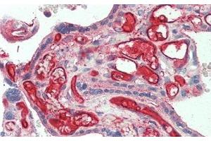 Immunohistochemistry (IHC) image for anti-Interleukin 22 Receptor, alpha 2 (IL22RA2) (AA 31-223) antibody (ABIN7435862)