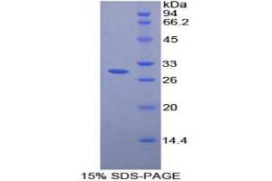 SDS-PAGE analysis of Rat FcgRII Protein. (Fc gamma RII (CD32) Protein)