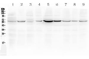 Western blot analysis of ESR2 using anti-ESR2 antibody . (ESR2 antibody  (AA 289-501))