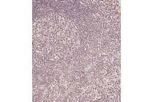 Immunohistochemical analysis of (ABIN6243102 and ABIN6578913) on paraffin-embedded Human tonsil tissue. (CDC25A antibody  (Ser124))