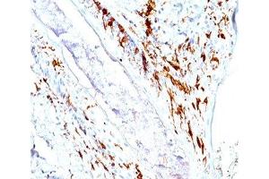IHC testing of human skin stained with CD1a antibody cocktail (O10 + C1A/711). (CD1a antibody)