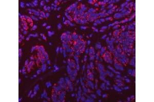IF analysis of VPS53 using anti-VPS53 antibody (ABIN7599731). (VPS53 antibody  (AA 11-699))