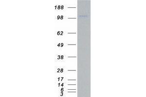 Validation with Western Blot (ULK1 Protein (Myc-DYKDDDDK Tag))