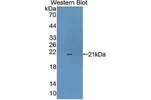Western blot analysis of the recombinant protein. (Complexin 1 antibody  (AA 1-134))