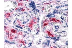 Immunohistochemical analysis of paraffin-embedded human Liver tissues using NKX3A antibody (NKX3-1 antibody)