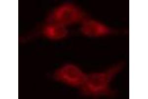 ABIN6269128 staining HeLa cells by IF/ICC. (MYB antibody  (C-Term))