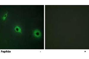 Immunofluorescence analysis of HepG2 cells, using CELSR3 polyclonal antibody . (CELSR3 antibody)