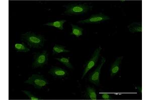 Immunofluorescence of monoclonal antibody to PDE3A on HeLa cell. (PDE3A antibody  (AA 533-640))