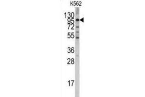 Western Blotting (WB) image for anti-Leucine-Rich Repeat Containing G Protein-Coupled Receptor 5 (LGR5) antibody (ABIN3001607) (LGR5 antibody)