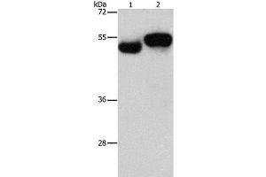 Western Blot analysis of Human fetal brain and liver tissue using AMZ1 Polyclonal Antibody at dilution of 1:1000 (AMZ1 antibody)