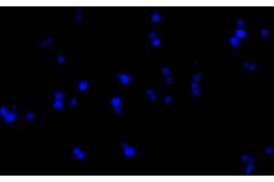 Immunofluorescence staining of 293F cells with ABIN7193151 at 1:100, counter-stained with DAPI. (HA-Tag antibody)
