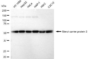 Western blotting analysis using Sterol carrier protein 2 antibody (ABIN7800440).