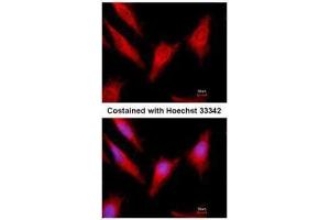 ICC/IF Image Immunofluorescence analysis of methanol-fixed HeLa, using Protein C, antibody at 1:500 dilution. (PROC antibody)