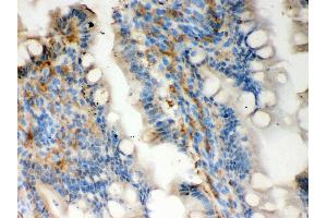 Anti- Galectin3 Picoband antibody, IHC(P) IHC(P): Rat Intestine Tissue (Galectin 3 antibody  (AA 153-264))