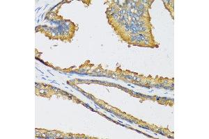 Immunohistochemistry of paraffin-embedded human prostate using CXCL11 antibody at dilution of 1:100 (40x lens). (CXCL11 antibody)