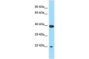 Western Blotting (WB) image for anti-SAR1 Homolog B (SAR1B) (Middle Region) antibody (ABIN2786596)