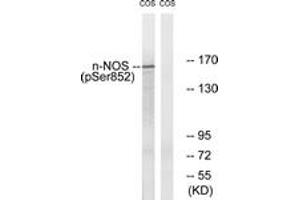 Western blot analysis of extracts from A549 cells, using n-NOS (Phospho-Ser852) Antibody. (NOS1 antibody  (pSer852))