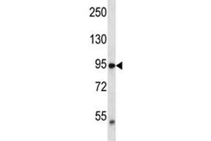 TRPV2 antibody western blot analysis in MDA-MB435 lysate. (TRPV2 antibody  (AA 52-81))