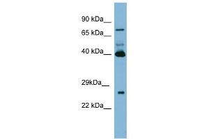 Transglutaminase 3 antibody used at 1 ug/ml to detect target protein. (TGM3 antibody)