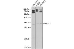 Western blot analysis of extracts of various cell lines, using H antibody (ABIN6128001, ABIN6141595, ABIN6141596 and ABIN6225185) at 1:1000 dilution.