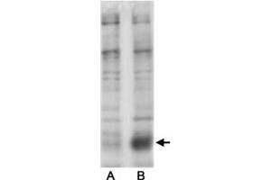 Western blot analysis of Phospho-Slc9a3 S605 in transfected COS-7 cells (Lane A. (SLC9A3 antibody  (pSer605))