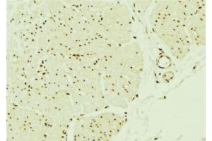ABIN6276512 at 1/100 staining Mouse muscle tissue by IHC-P.