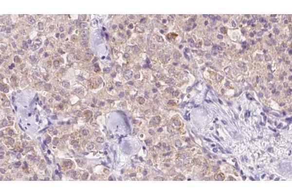 VPS11 antibody  (Internal Region)
