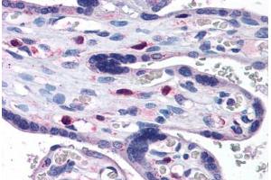 Human Placenta: Formalin-Fixed, Paraffin-Embedded (FFPE) (SNX16 antibody  (AA 2-14))
