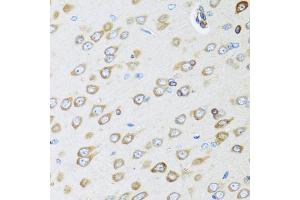 Immunohistochemistry of paraffin-embedded rat brain using OGN antibody (ABIN5975049) at dilution of 1/100 (40x lens). (OGN antibody)