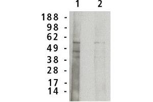 Image no. 1 for anti-Sphingomyelin phosphodiesterase 1, Acid Lysosomal (SMPD1) antibody (ABIN201736) (SMPD1 antibody)